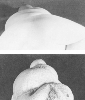Figure 3. Photographs comparing a six-months pregnant 26 year old Caucasian female of average weight with a cast of Willendorf Number 1 (McDermott 1996, 243).